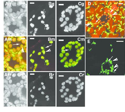 Tissue Specific Variations In Stromule Abundance And Plastid