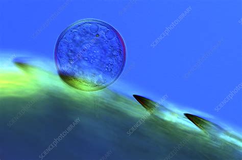 Shelled Amoeba Light Micrograph Stock Image C025 8931 Science