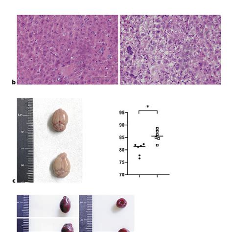 Pten Knockout In Kidney Caused Water Retention In Multiple Organs A