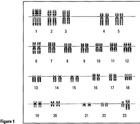 Laboratory Activity #18 - Making Karyotypes