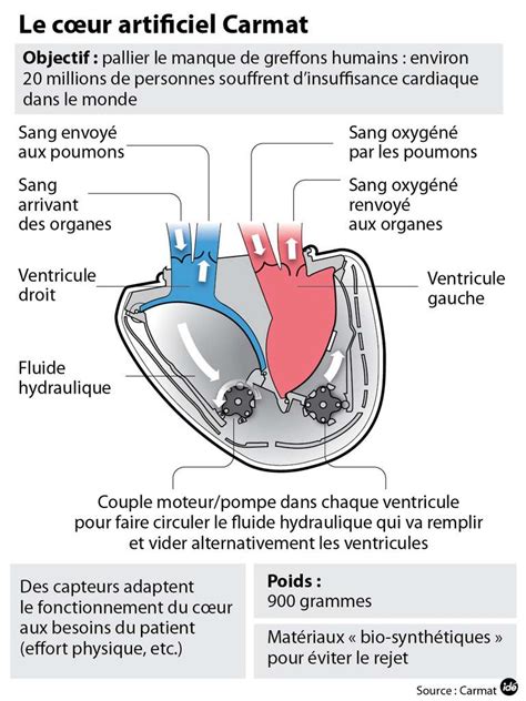 Coeur artificiel Carmat : feu vert pour des transplantations - L'influx