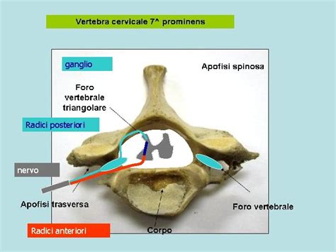 Sistema Nervoso Periferico Struttura Nervi Spinali Plessi Nervi