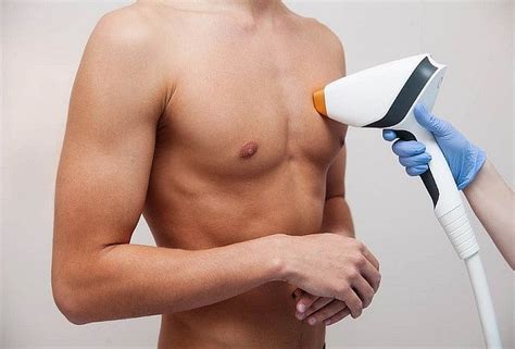 8 Ses depilación Laser Diodo full body Hombres Cuponatic