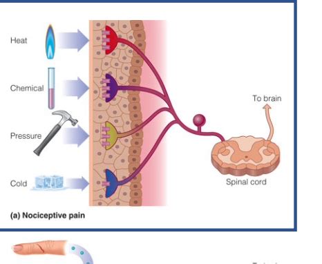 Cours 10 Perception De La Douleur Sens Chimiques Flashcards Quizlet