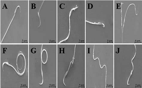 Scanning Electron Microscopy Pictures Showing Sperm From Cauda