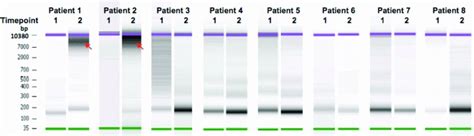 Microfluidic Electrophoresis Analysis Of Cfdna Fragment Length Dna