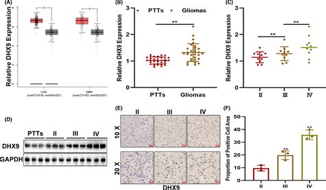 Rnabinding Protein Dhx Promotes Glioma Growth And Tumorassociated