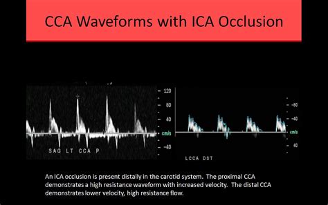 Cci Vascular Ultrasound Registry Review Course