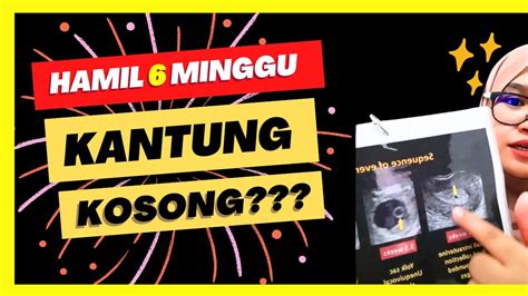 Hamil Minggu Tapi Kantung Kosong Upt Positif Tapi Scan Kantung Janin