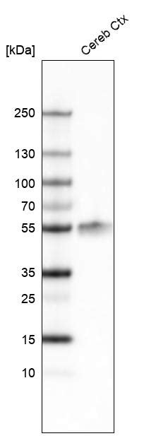 Mouse Monoclonal Anti Lhx Antibody Buy For Research Highly