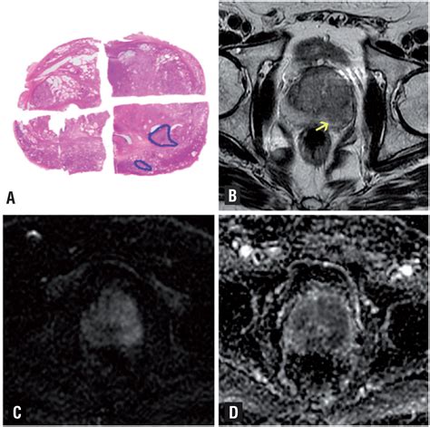 Scielo Brasil Diagnostic Accuracy Of Multiparametric Magnetic