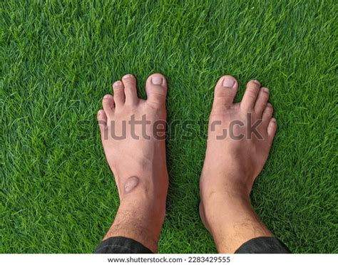 Closeup Barefoot Man Walking On Grassy Stock Photo 2283429555 ...