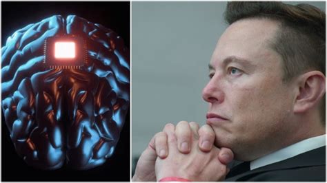 Elon Musk A Anun At C Vrea S Implanteze Primul Cip N Creierul Unui