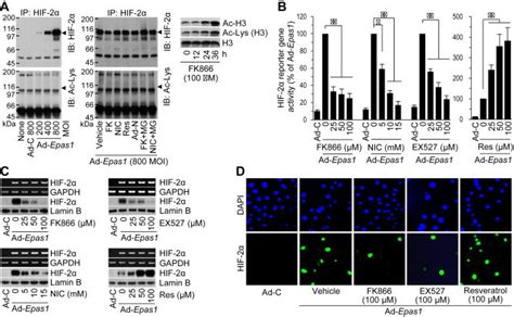 The Nampt Nad Sirt Axis Regulates The Stability And Transcriptional