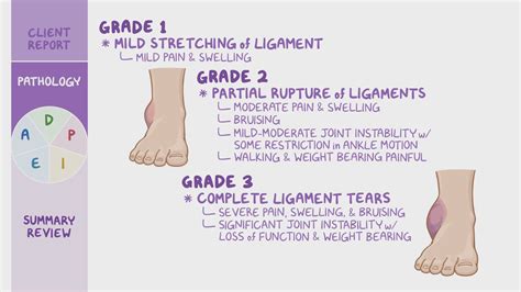 Musculoskeletal Injuries Nursing Process ADPIE Osmosis Video Library