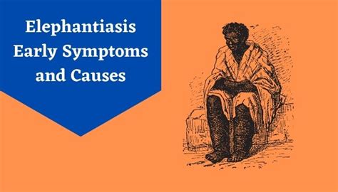 Elephantiasis Symptoms Common Signs And Symptoms Of Elephantiasis