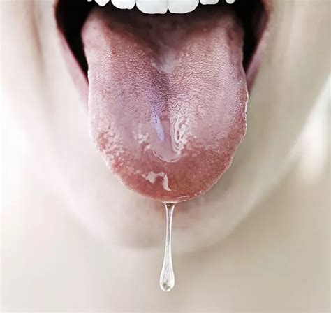 Lie Bumps On Tip Of Tongue