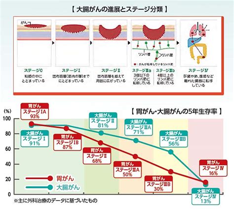 早期発見で消化管のがんは怖くない｜消化器内科・消化器内視鏡センター｜診療科・部門のご案内｜洛和会音羽病院（京都市山科区） 救急指定病院