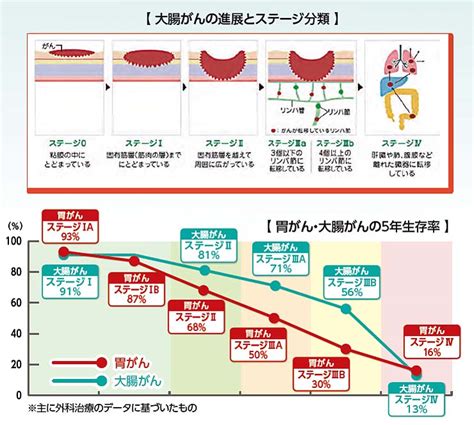 癌 ステージ1 完治 Hello Doctor