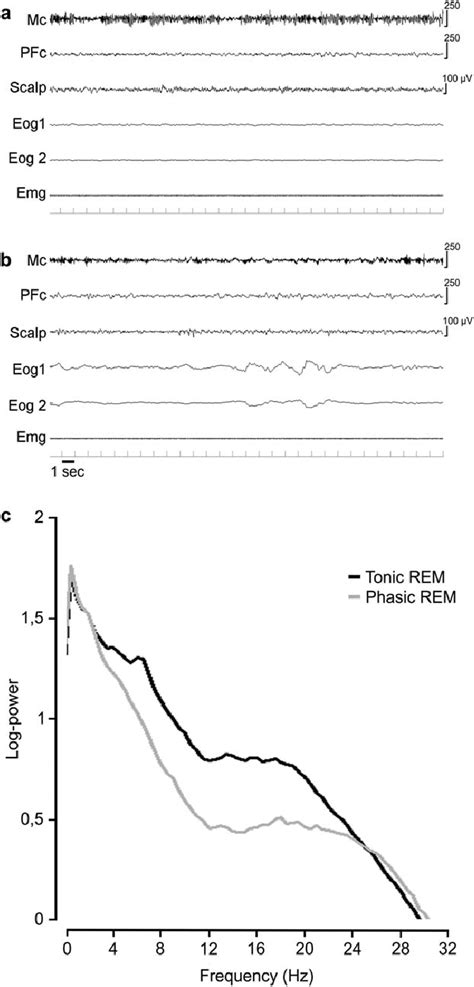 Example Of Tonic A And Phasic B Rapid Eye Movement Rem 30 Second