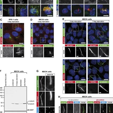 Glycylation In Primary Cilia Of Mdck Cells Is Length Dependent A Download Scientific Diagram