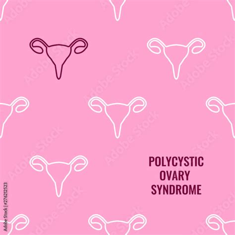 Polycystic Ovary Syndrome Awareness Poster With Pattern Of Uterus