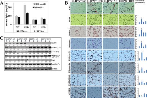 Effect Of Hfd On Lipids Signaling Proteins And Adipose Tissue