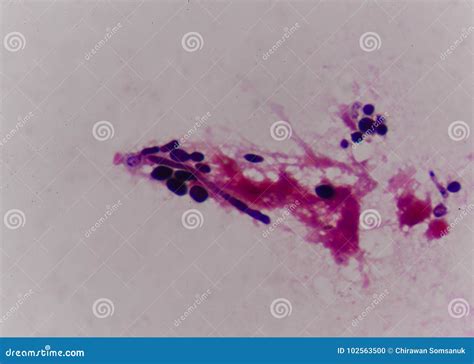 Budding Yeast Cell in Gram Stain Method. Stock Photo - Image of microscopic, macro: 102563500