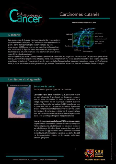 PDF Carcinomes cutanés DOKUMEN TIPS