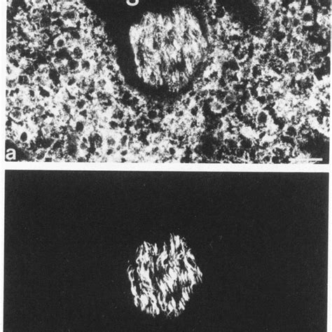 Double Label Immunofluorescence Microscopy Of A Frozen Section Of A