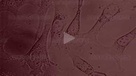 Hela Cells In Culture Light Microscop Stock Video Science Source