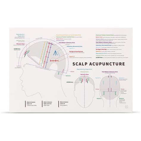 Scalp Acupuncture Print 19 X 13 Chinese Etsy