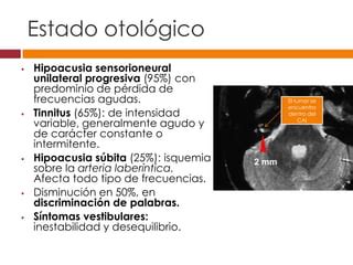 Neurinoma del acústico o schawnnoma vestibular 2013 PPT