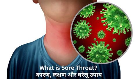 गले में इन्फेक्शन के लक्षण कारण और उपचार Sore Throat In Hindi