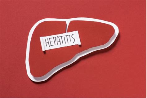 Kemenkes Penyebab Hepatitis Akut Misterius Belum Jelas Genpi Co Banten