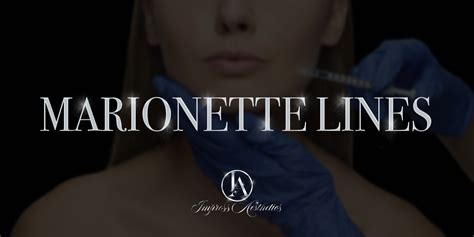 Marionette Lines — Impress Aesthetics