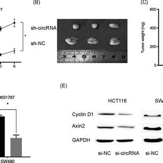 Identification And Characterization Of Hsa Circ 0031787 In CRC A