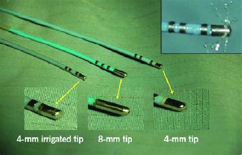 Catheters Most Frequently Used For RF Ablation From Schmitt C