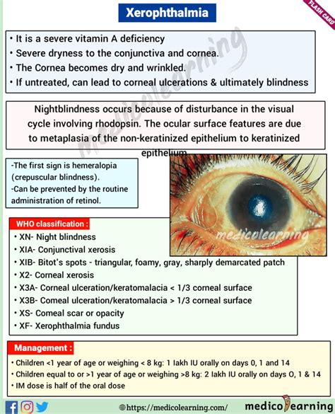 Xerophthalmia Medicolearning