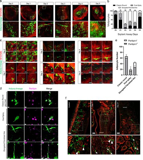 Spatio Temporal Characterization Of Migratory Adipocytes A