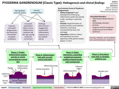 Pyoderma Gangrenosum: Pathogenesis and Clinical Findings | Calgary Guide