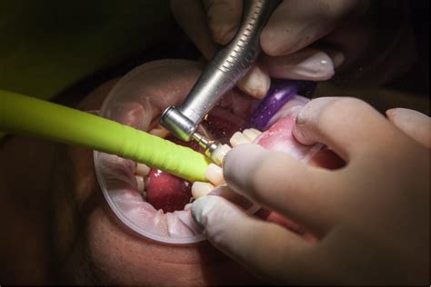 Understanding The Sedation Option For Dental Procedures