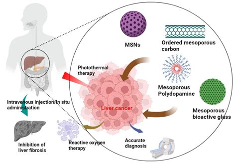 Pharmaceutics Free Full Text Mesoporous Nanoparticles For Diagnosis