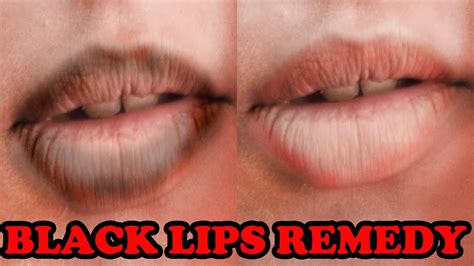 How To Get Black Marks Off Your Lips From Smoking Lipstutorial Org