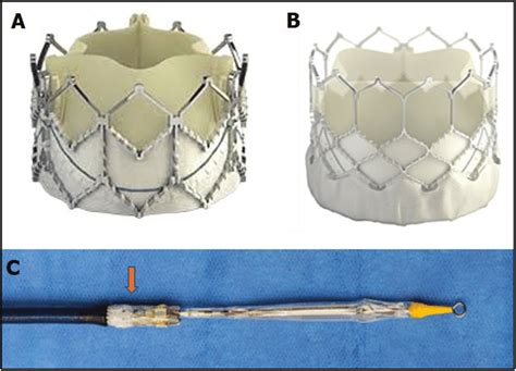 A Sapien Xt Valve B Sapien 3 Valve C Reverse Crimped Sapien 3