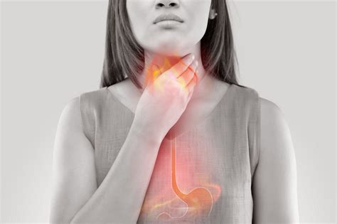 Reflux gastro œsophagien comment le soulager et le traiter Pleine vie