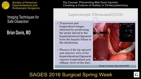 Imaging Techniques For Safe Dissection Ioc And Other Methods Of Biliary