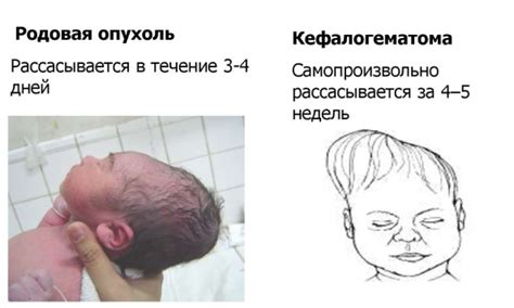 Череп младенца: особенности анатомии, как выглядит, до скольки лет ...