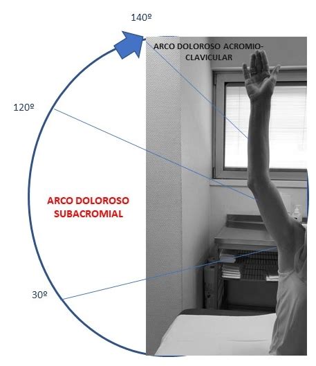 Diagn Stico Por Imagen En M Sculo Esquel Tico Hombro