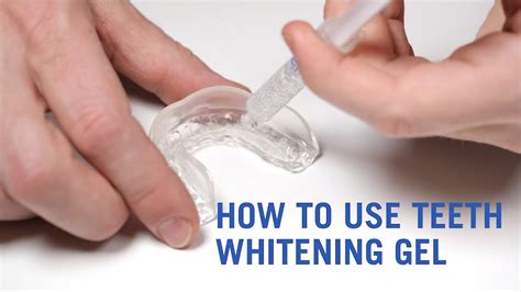 How To Easily Apply Teeth Whitening Gel Youtube